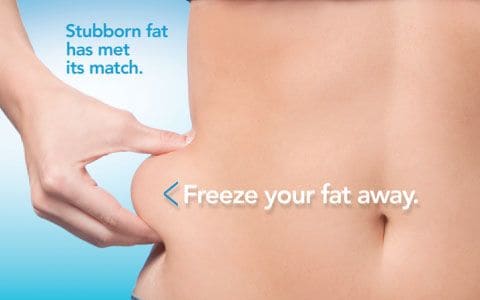 Hips treatment Sutton in Ashfield From Lipo Sculpt