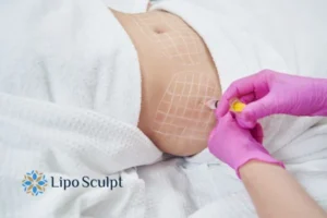 Are The Results From Aqualyx Permanent? 1 Do you want to know how long Aqualyx Sutton in Ashfield results last?