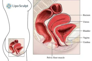 Treatment For A Leaky Bladder 2 How EM Chair treatment Sutton in Ashfield can help Leaky bladder issues. Read more now!