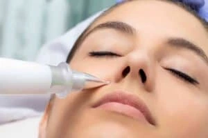 Best Actinic Keratoses Removal 3 Actinic keratoses Sutton in Ashfield solutions - book in today!