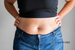Bidding Farewell to Muffin Tops with Aqualyx Fat Injections 2 Do you wish you could reduce your muffin top Sutton in Ashfield With Aqualy fat dissolving injections you can!
