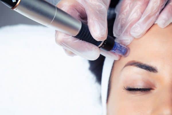 Explaining Total Skin Tightening Treatment and What to Expect 2 What Skin Concerns Can Total Skin Tightening Treatment Help With Sutton in Ashfield?